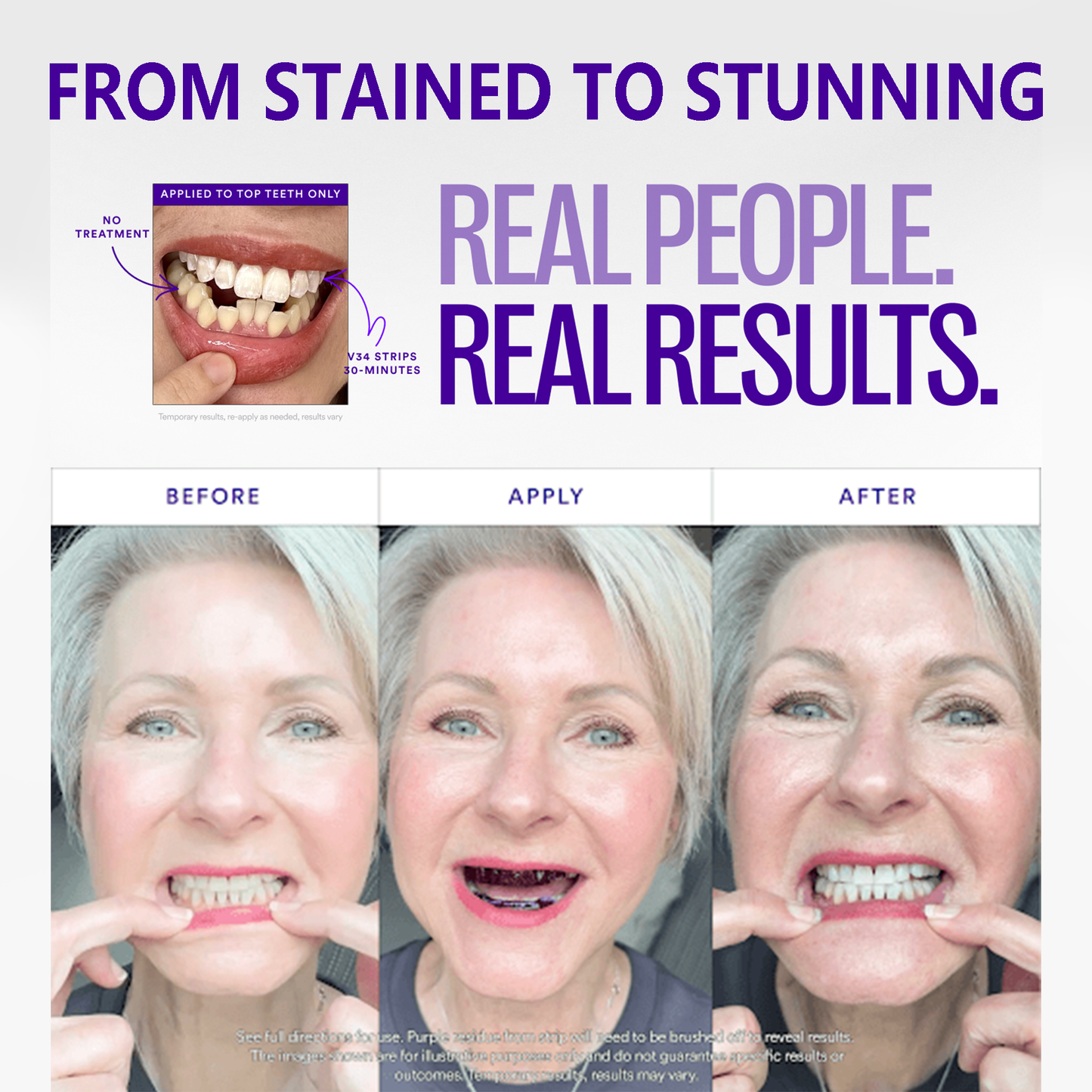 Clinclii™ Whitening Strips – Professional Teeth Whitening at Home