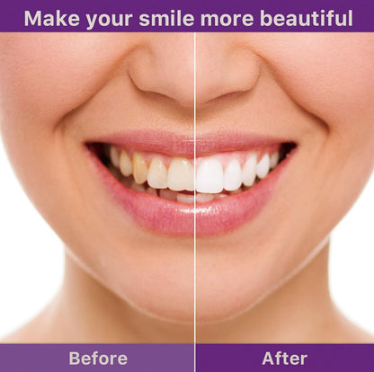 Clinclii™  Whitening Strips – Professional Teeth Whitening at Home